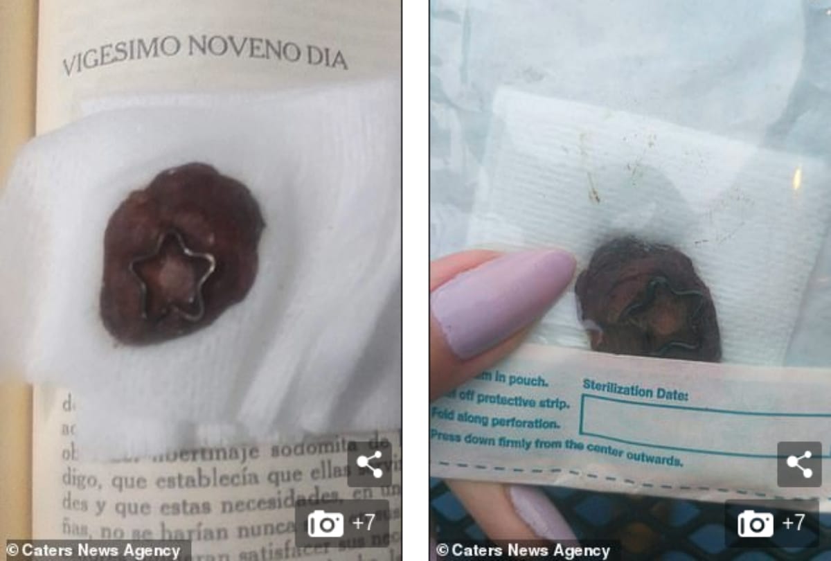 Mexican women removes her belly button and gifted to her boyfriend