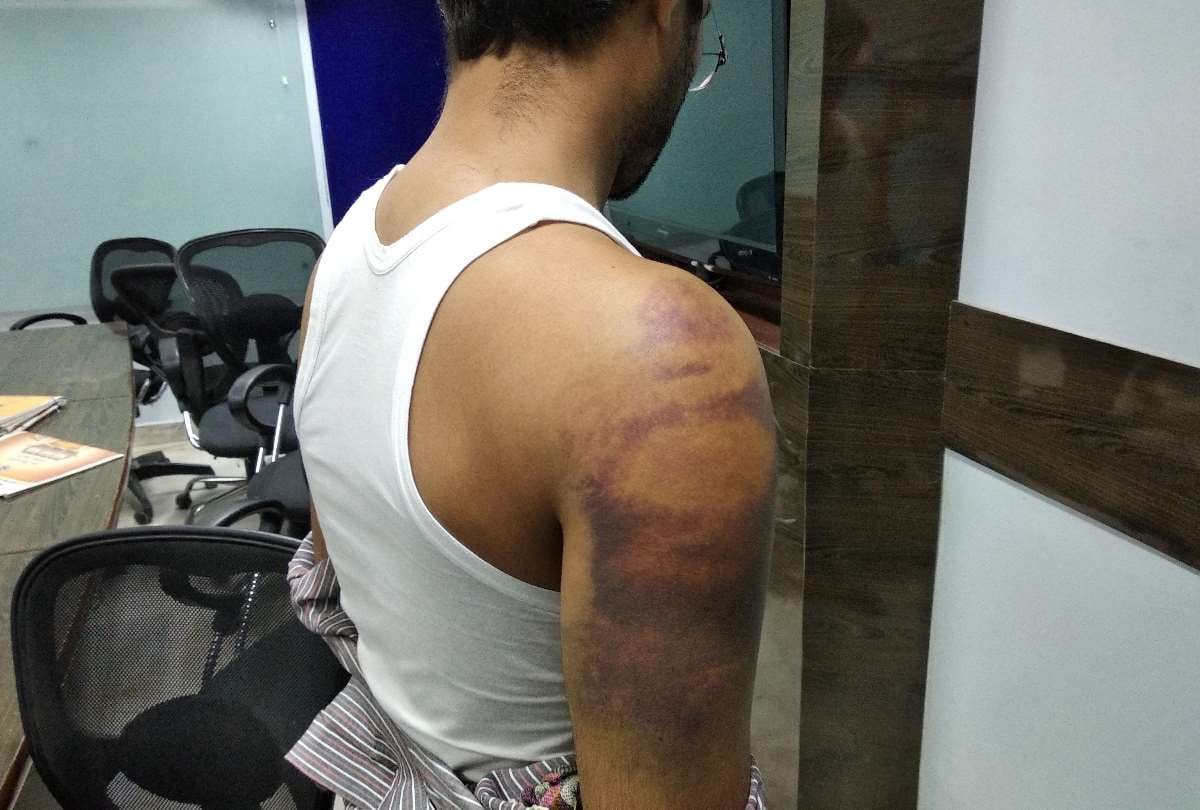 contractor beats tutor because his son could not get good marks