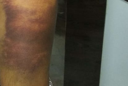 contractor beats tutor because his son could not get good marks