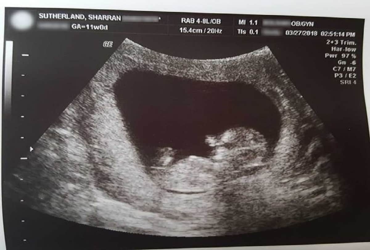 Brave mum shares images of her dead son