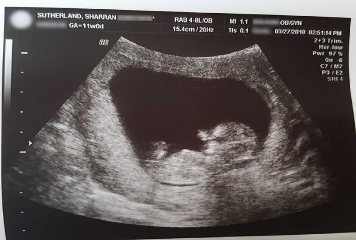 Brave mum shares images of her dead son