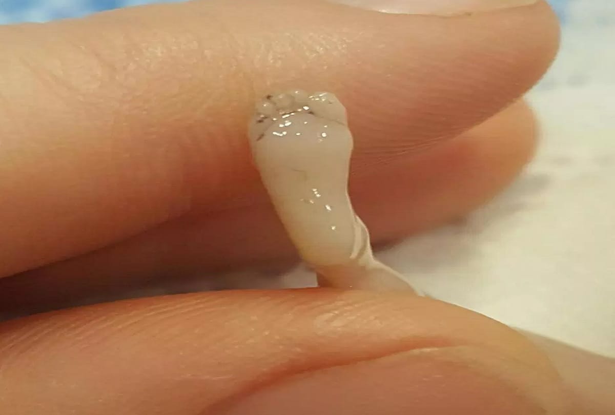 Brave mum shares images of her dead son