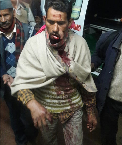 By the day-long attack, the bear injured the villager