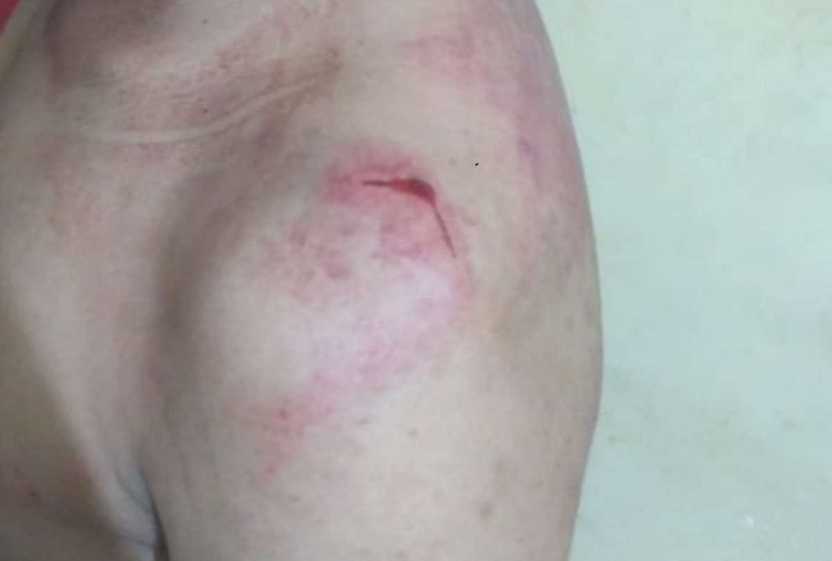 An integral student attacked in Gudamba in Lucknow