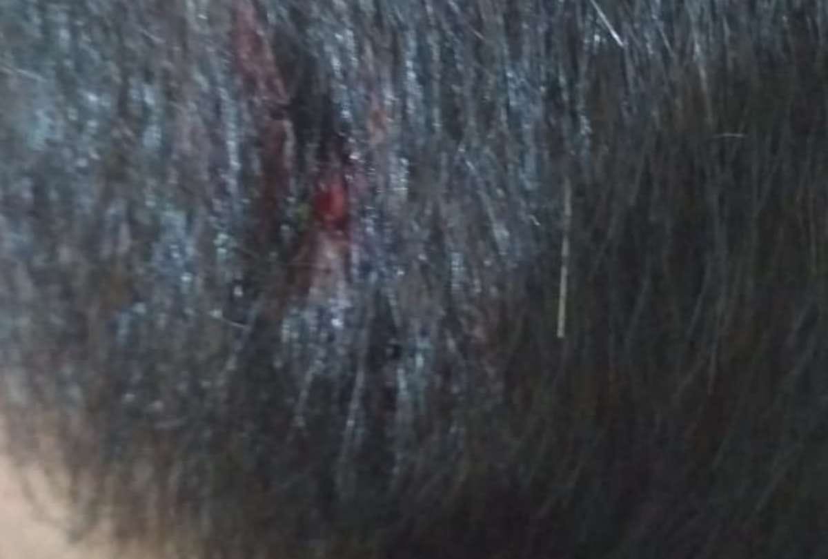 An integral student attacked in Gudamba in Lucknow