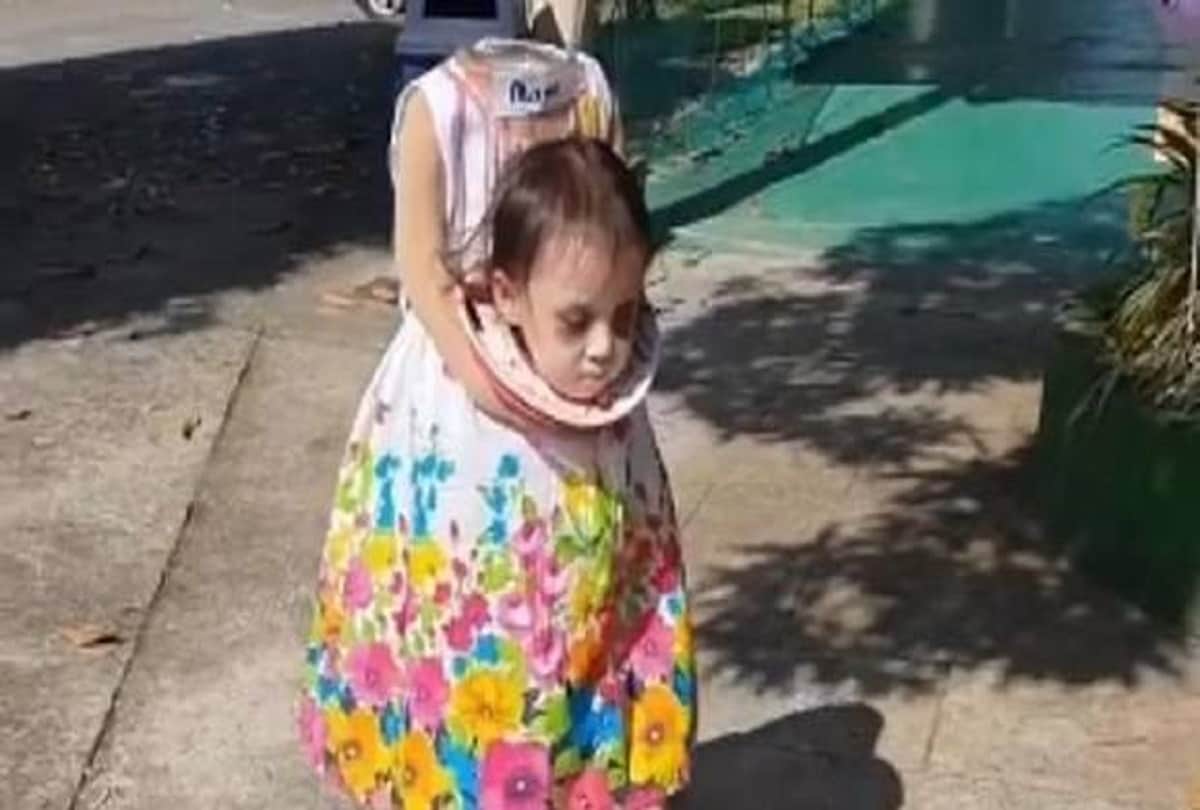 Halloween 2018: 2 year old girl carries 'her own severed head' goes viral