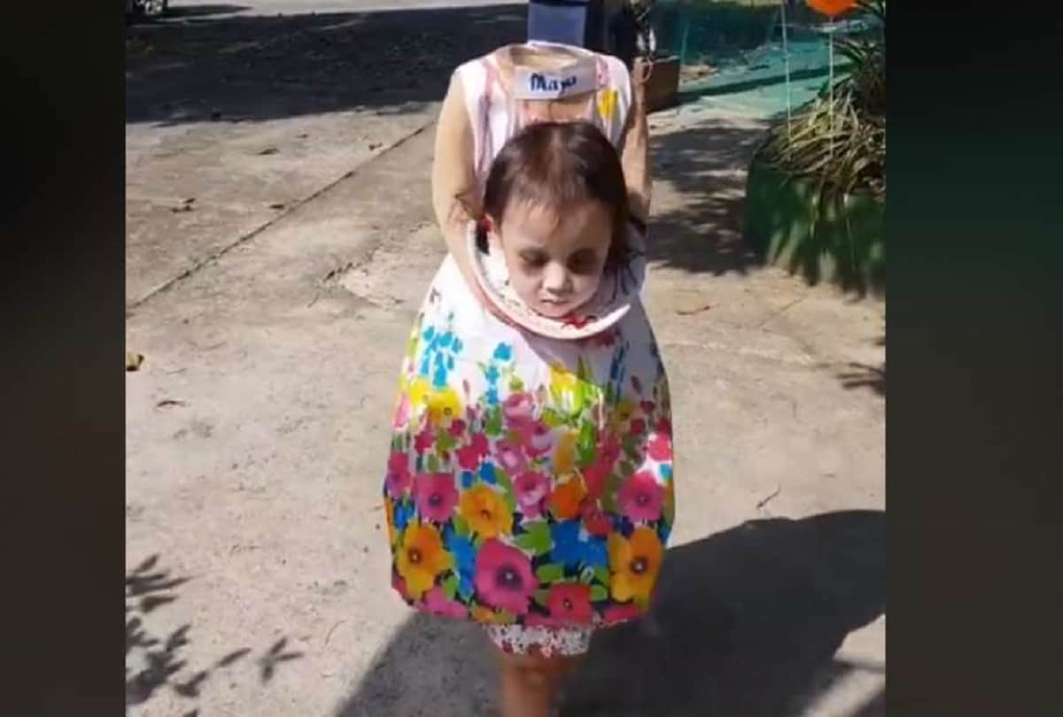 Halloween 2018: 2 year old girl carries 'her own severed head' goes viral