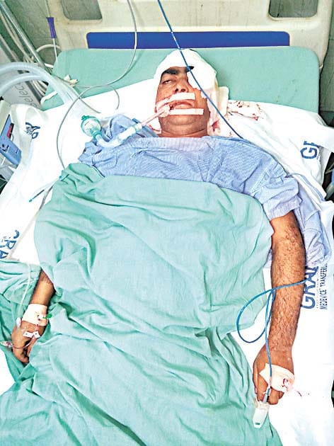 injured man in coma.