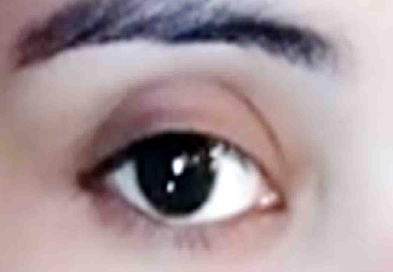 your eye says about your health in hindi