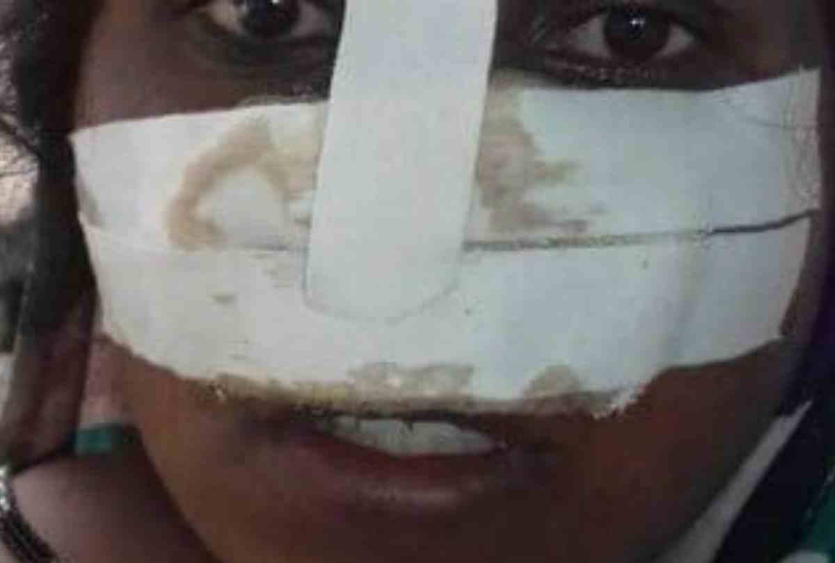 husband cut his wife nose after dispute
