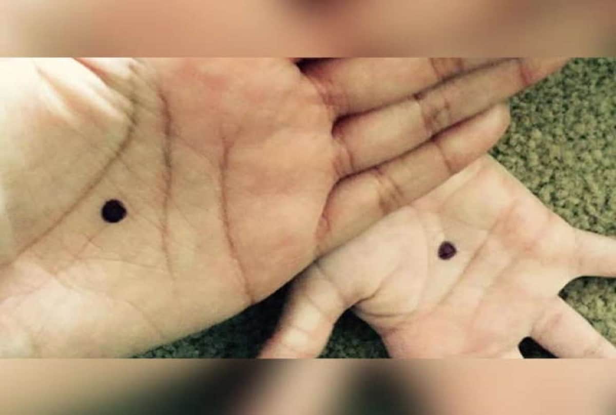 Notice Spot A black Dot On Someone's Palm, Call The Police immediately