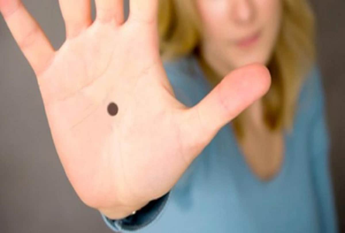 Notice Spot A black Dot On Someone's Palm, Call The Police immediately