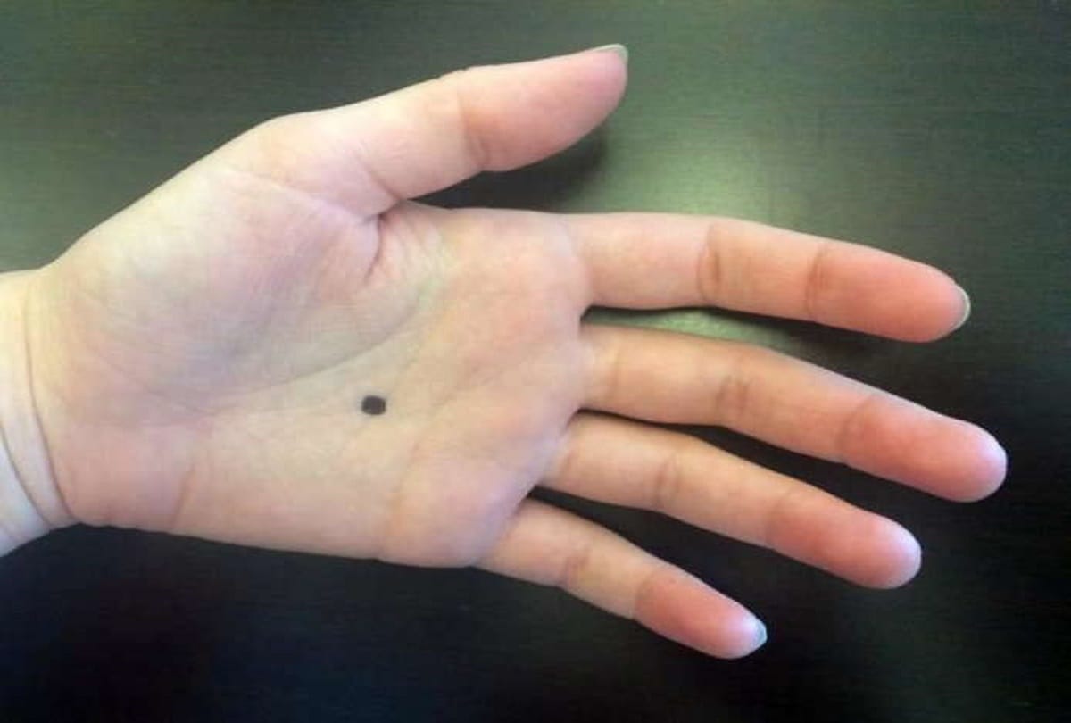 Notice Spot A black Dot On Someone's Palm, Call The Police immediately
