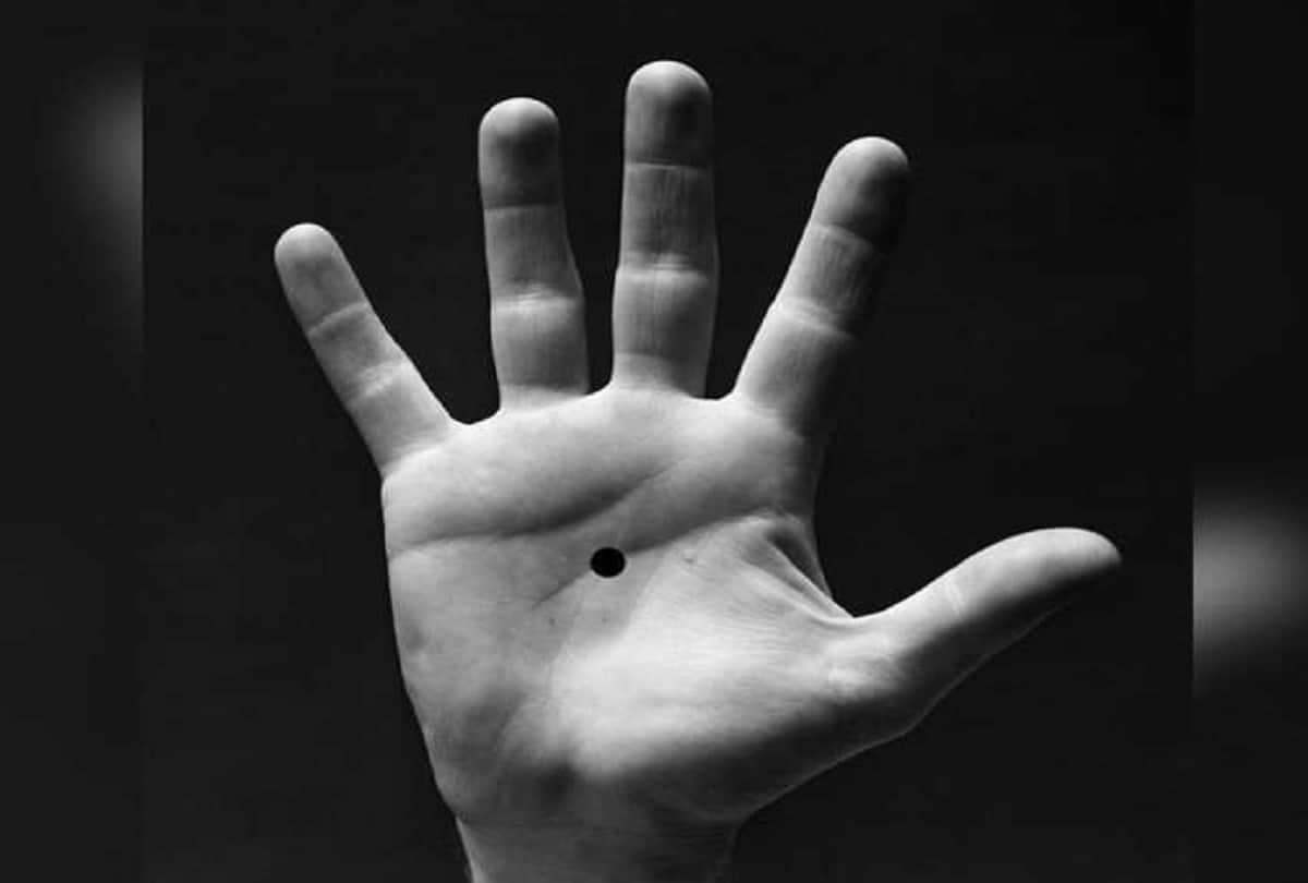 Notice Spot A black Dot On Someone's Palm, Call The Police immediately