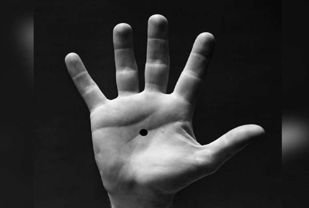 Notice Spot A black Dot On Someone's Palm, Call The Police immediately