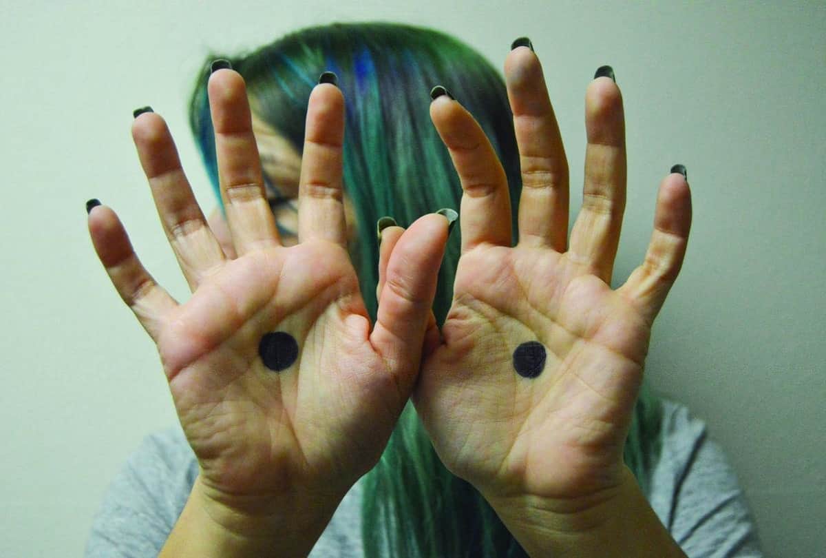 Notice Spot A black Dot On Someone's Palm, Call The Police immediately