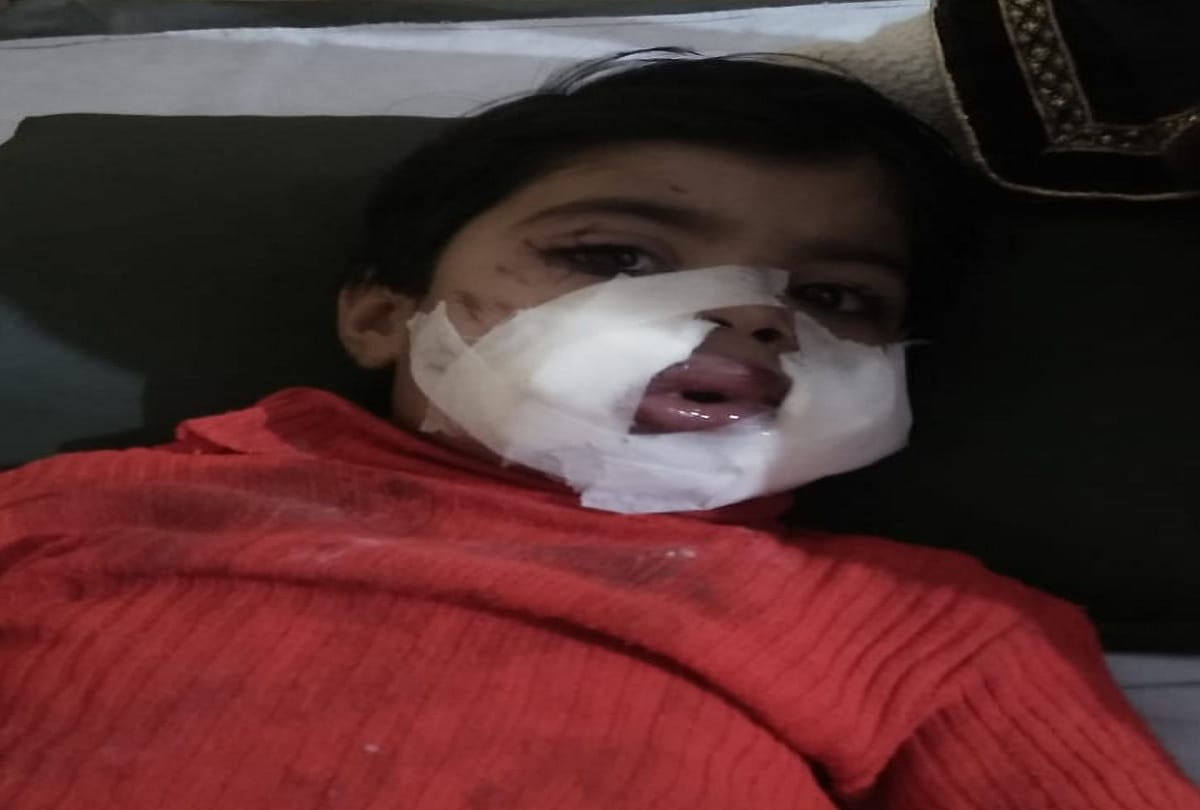 Uttar pradesh bomb cracked in mouth of Three year old girl in meerut