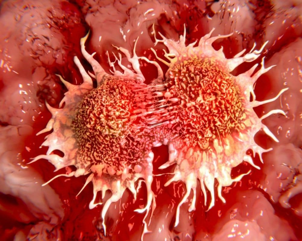 know about diseases of prostate and its treatments