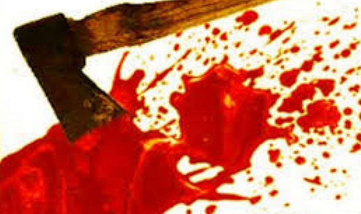 outrage for land dispute in azamgarh son leg cut while mother injured