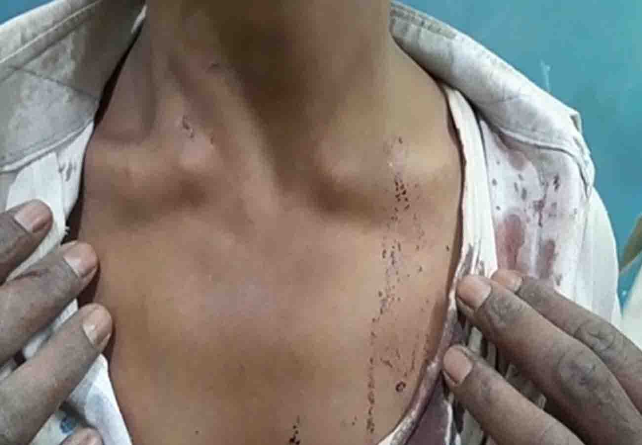 leopard attacks 7 people in hamirpur