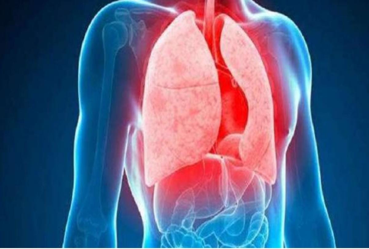 tuberculosis harmful disease can affects these people especially