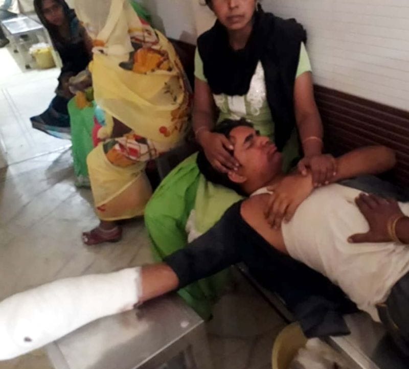 आतिशबाजी के धमाके से युवक घायल