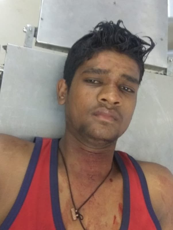 छठ घाट पर जा रहे युवक पर गड़ासे से हमला