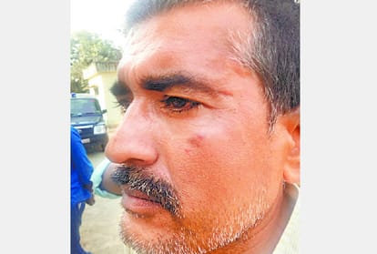 BJP leader got beaten in chanda in sultan pur.