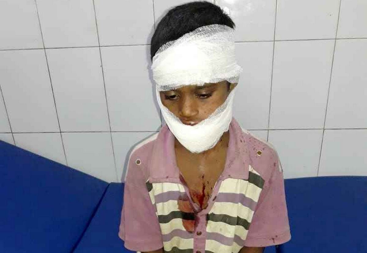 Drinker fire on child in varanasi