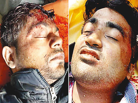 Two bike riders injured in vehicle collision