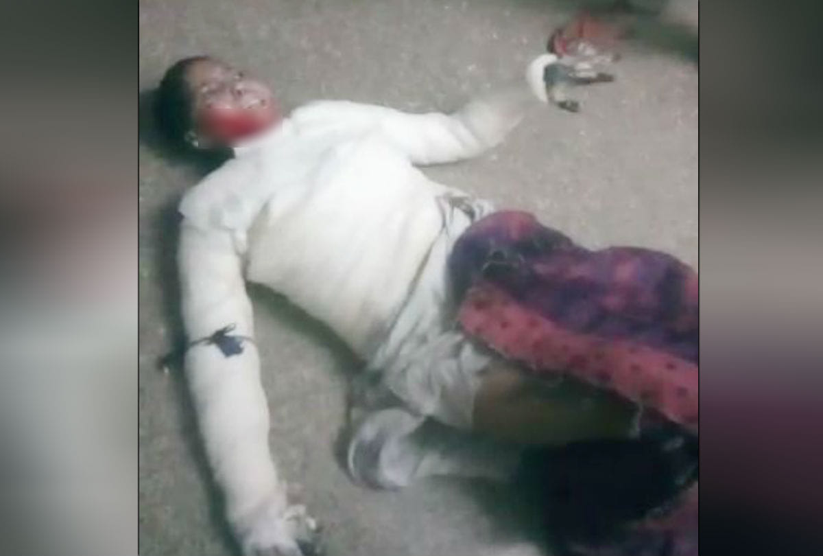 burnt woman put out from sn medical collage by doctor video goes viral in agra