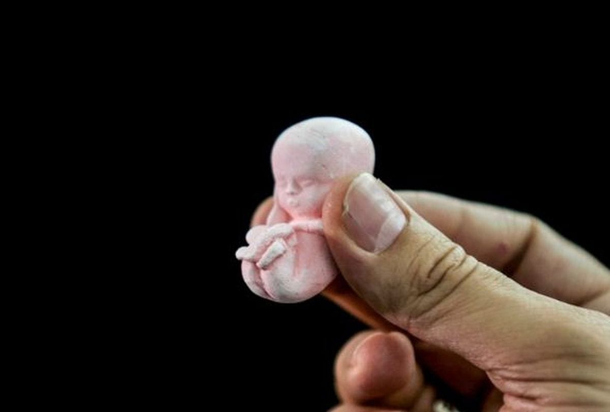 fetal gender screening and abortion by a gang in agra