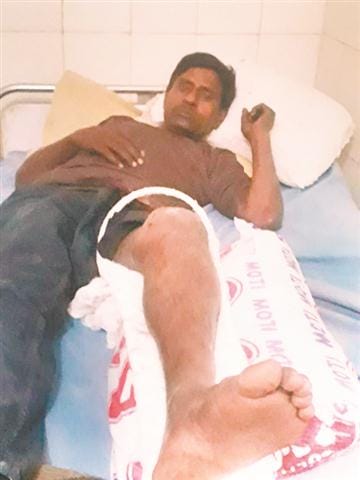 Workers were keen on breaking the foot in the rally, BJP did not stop