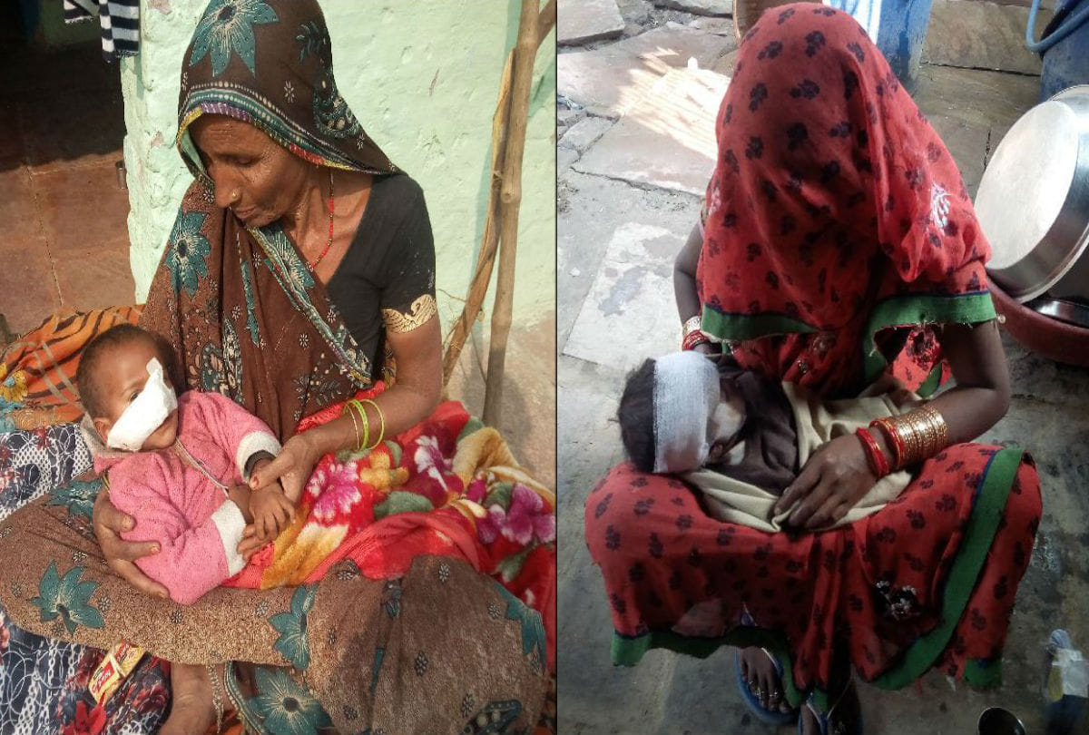 monkey attacked two children in agra