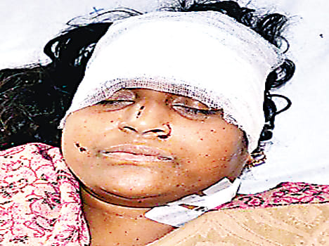 robbers injured women and looted house