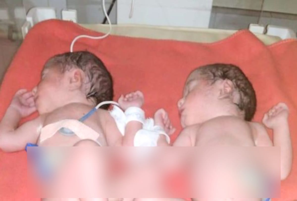 A woman gave birth to three sons together at mandi hospital