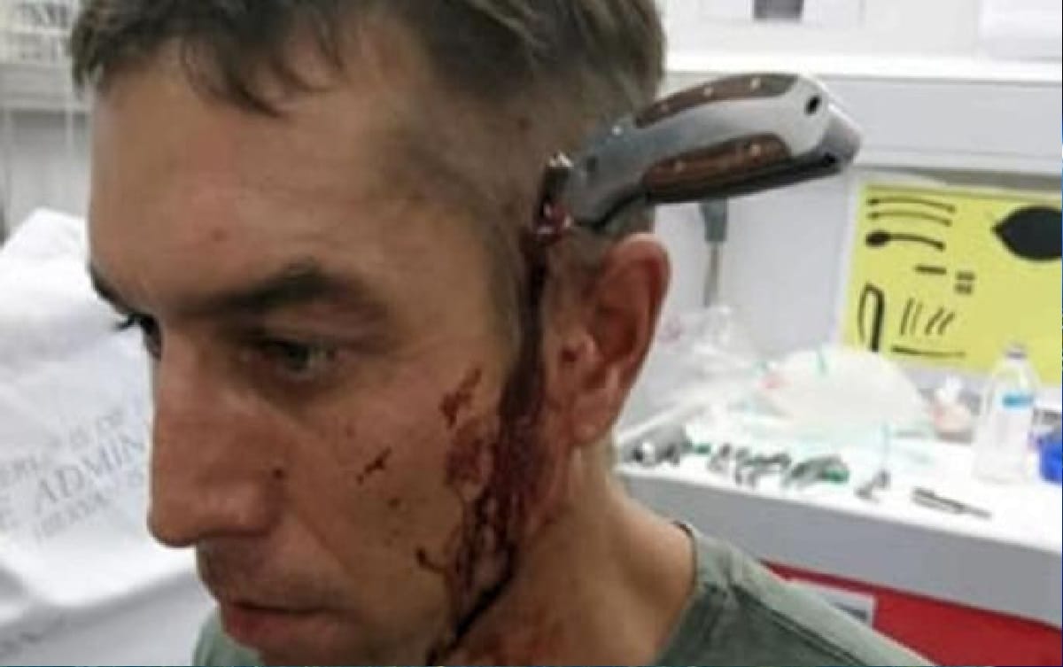 Horrific Knife Buried Attack in His Head Reached the Hospital by Cycling Himself