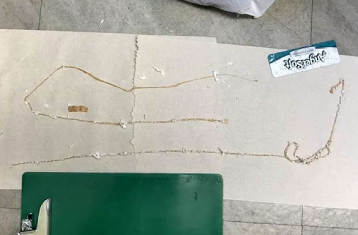5.5 Foot Long tapeworm Come out from human stomach