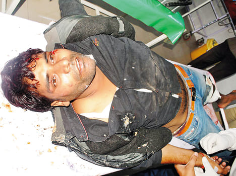25 thousand injured in police encounter
