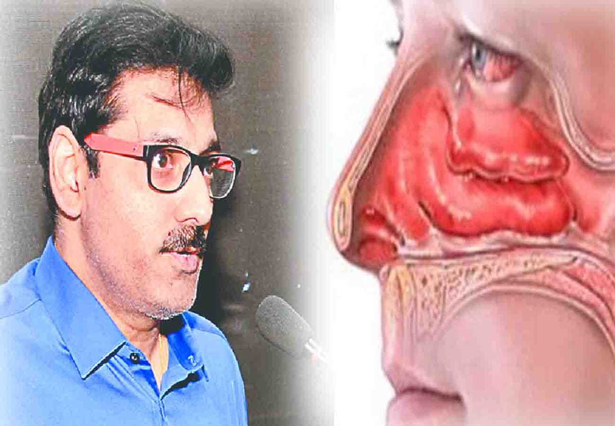 Rapidly growing nasal tumors in people living near the Ganges