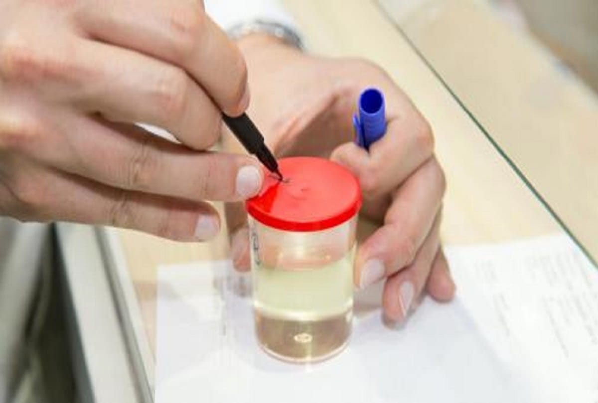 urine colour can indicate your health problem