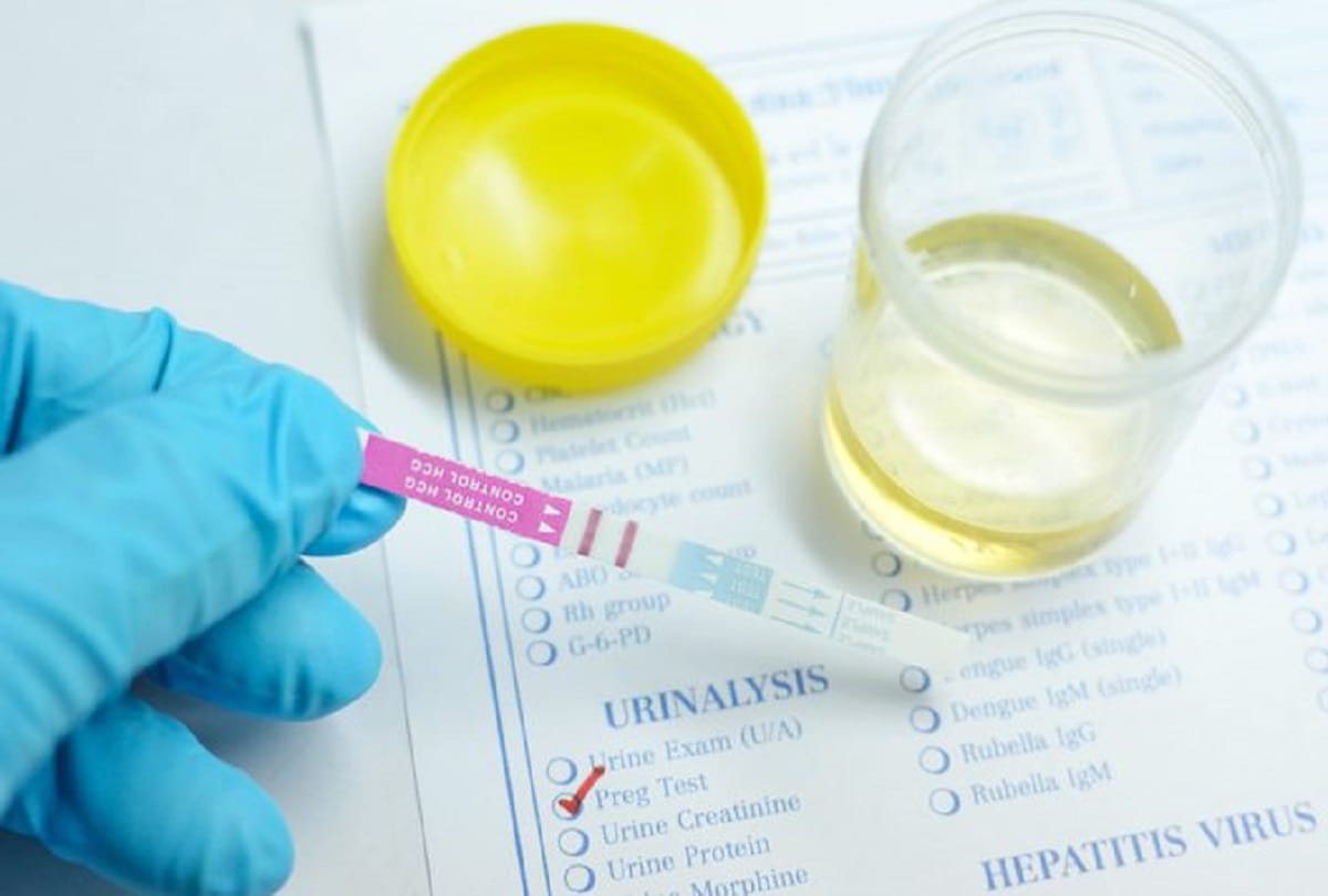 urine colour can indicate your health problem