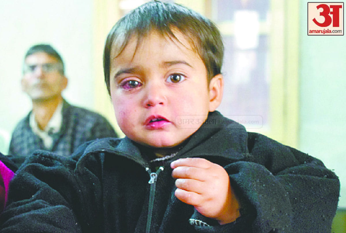 20 month old heeba got injured in stone pelting shopian jammu kashmir lost her eyes