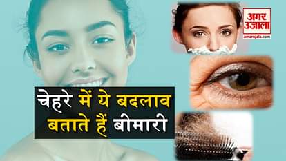 these face signs tell you about several disease