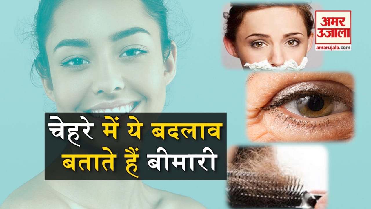 प्रतीकात्मक तस्वीर