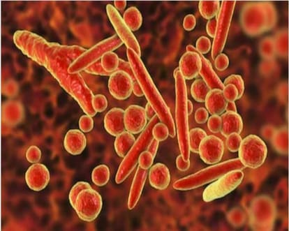A Sexual disease which can transformed into a superbug