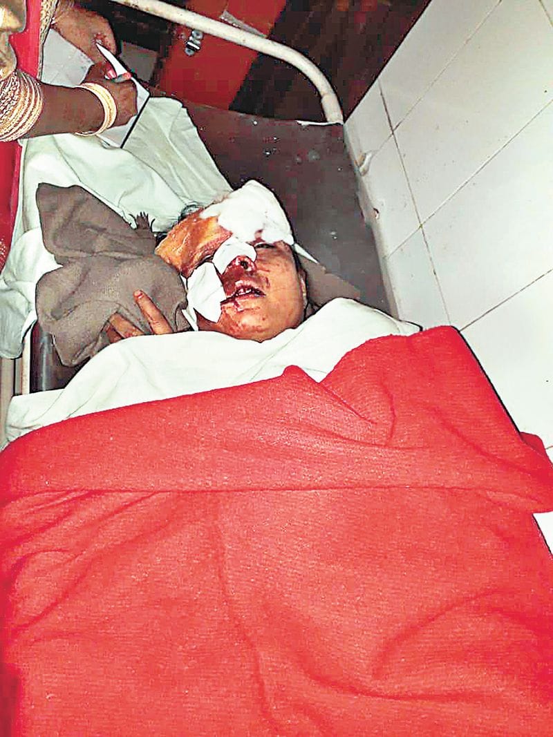 अनियंत्रित होकर पलटी बारातियों से भरी बस, 30 घायल
