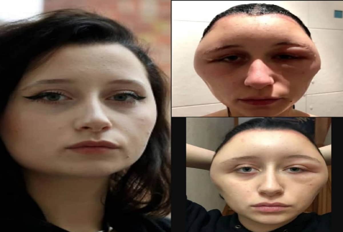 Strange News Hair Dye Colors Allergy Side Effects To Woman Weird Images