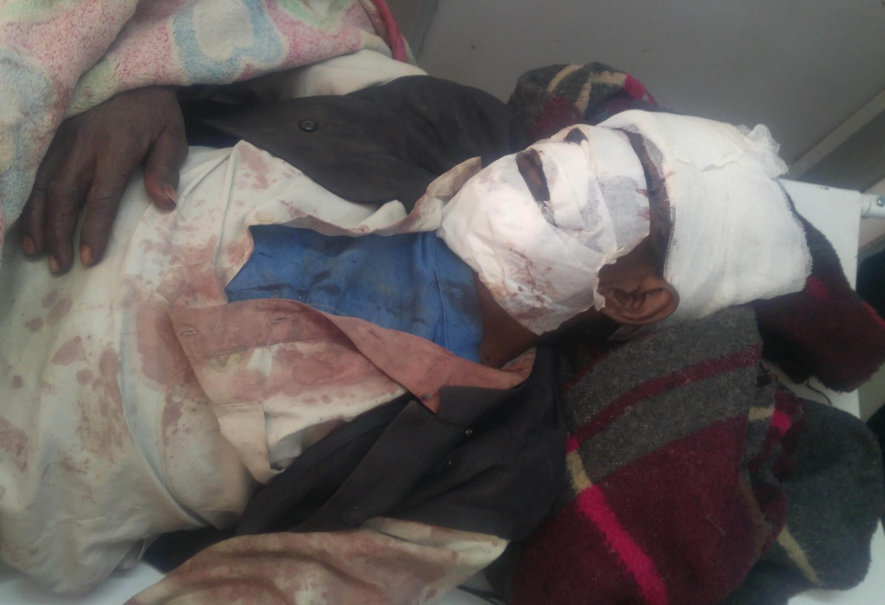 Firing in azamgarh and three people injured