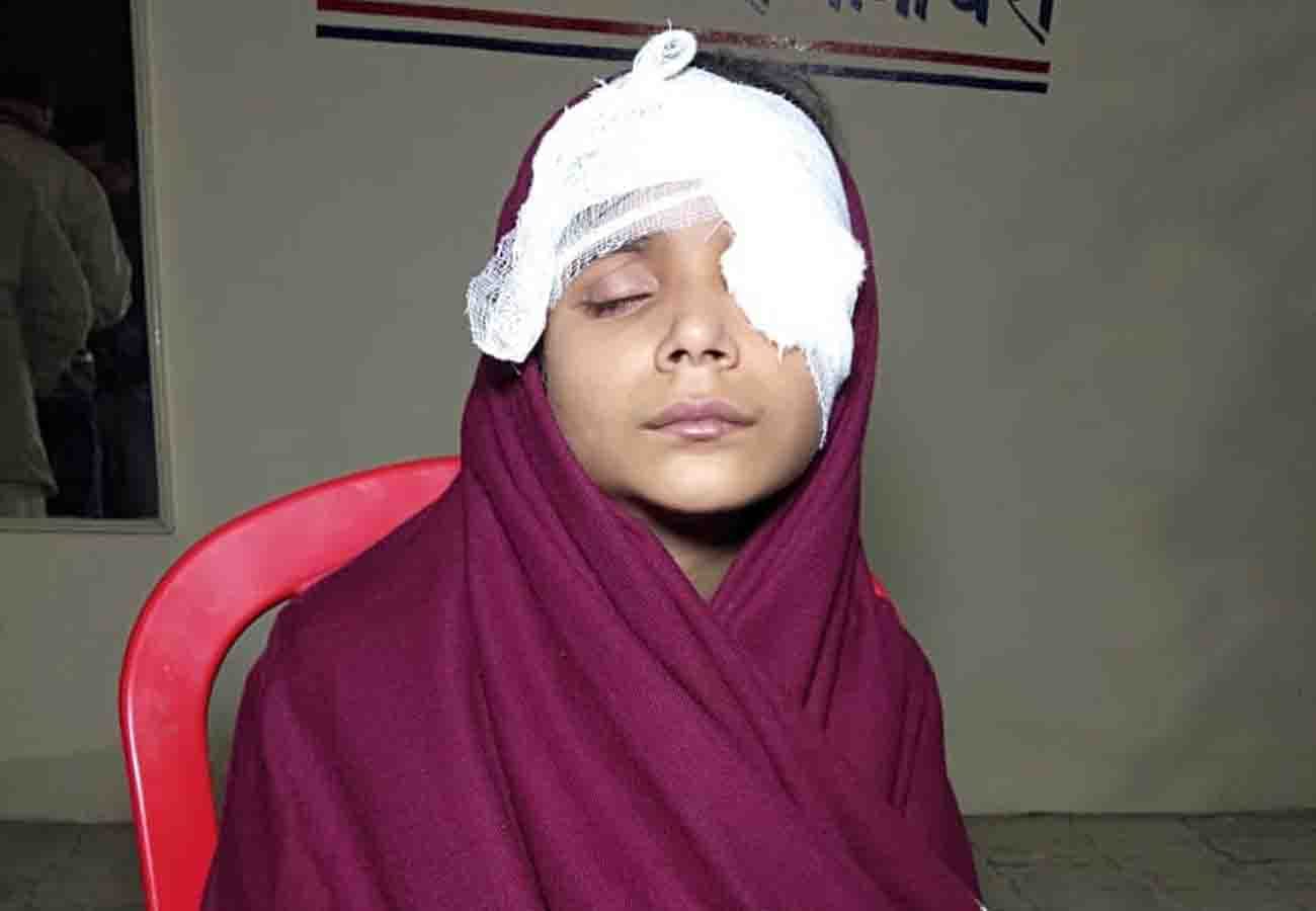 teacher thrown stick over girl and her eye damaged